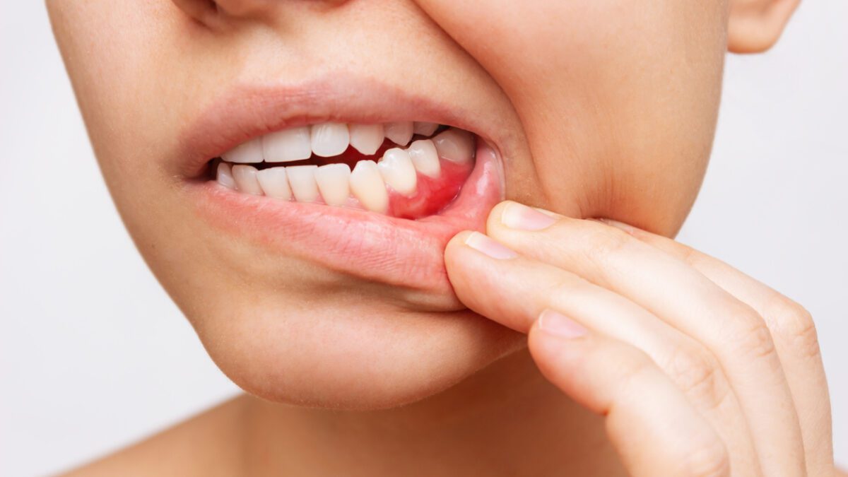 Learn how to recognize signs of tooth infection and when to seek treatment.