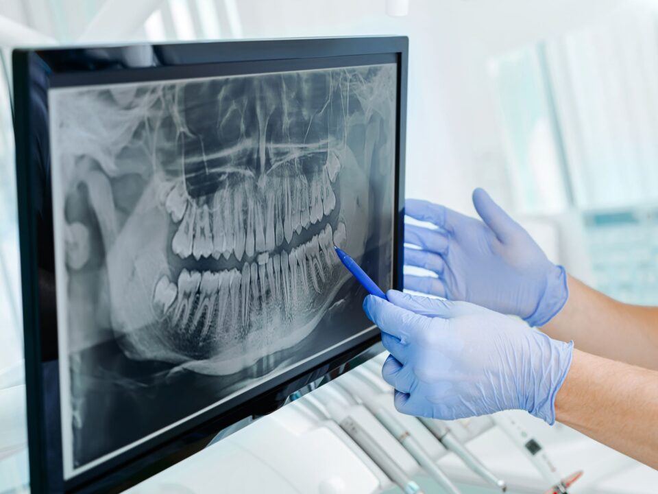 Learn about dental X-rays on our family dentistry practice’s blog.